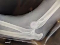 Wendrichs R&ouml;ntgenbild.