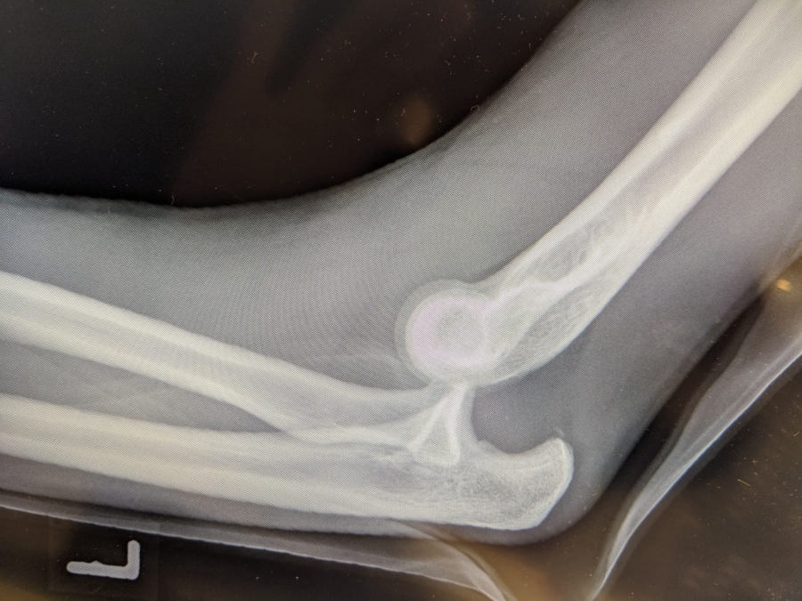 Wendrichs R&ouml;ntgenbild.